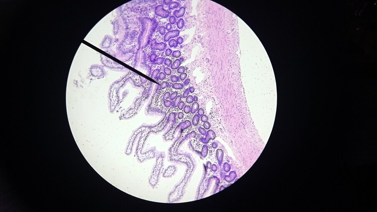 Microscopic image of small intestine tissue