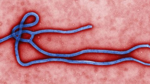 Colorized electron microscope image of an Ebola virus virion
