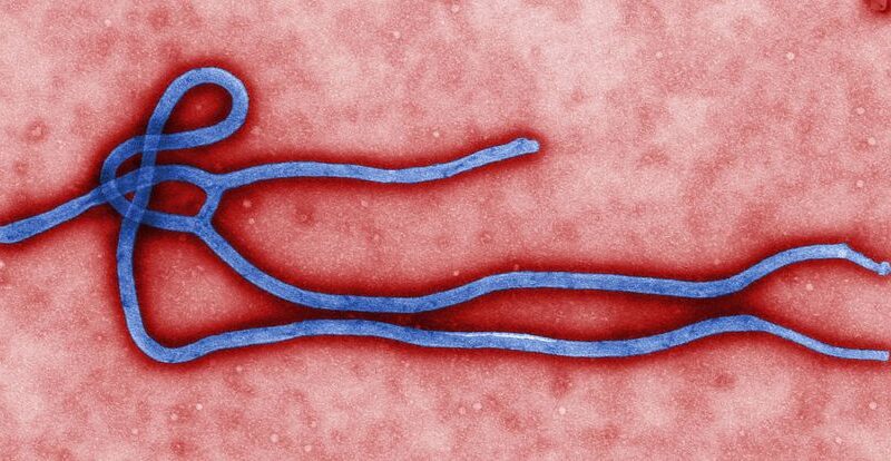 Colorized electron microscope image of an Ebola virus virion